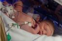 Baby Carter spent 24 hours in the Norfolk and Norwich University Hospital's NICU